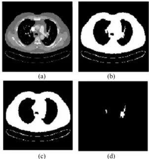 Fig. 4. The imaginative voxels of each 3D cross section of  pulmonary arteries, the regions of black color are imaginative PEs 