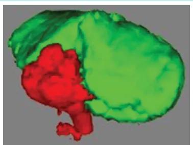 Figure 1.  Appearance of cerebellum