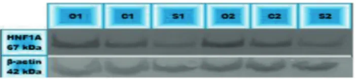 Figure 2. Western blot analysis of HNF1A overexpression and  siRNA induced silencing in MIN6 cells