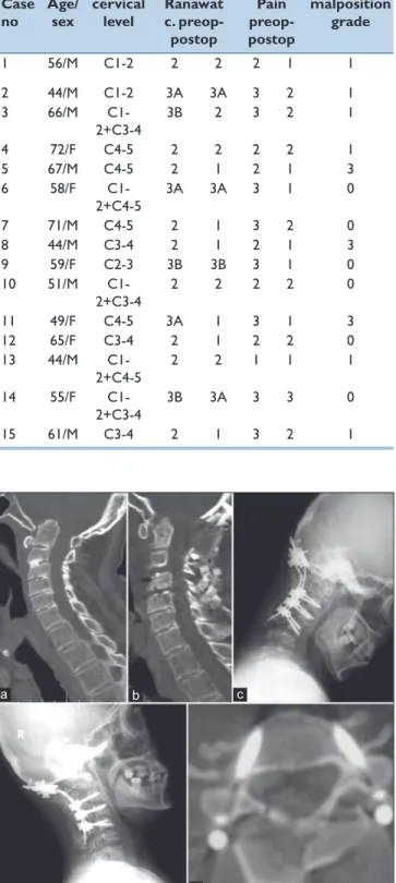 Table 1: Epidemiological data of enrolled patients  (n=15), according to pre-operative Ranawat score  and malposition grading