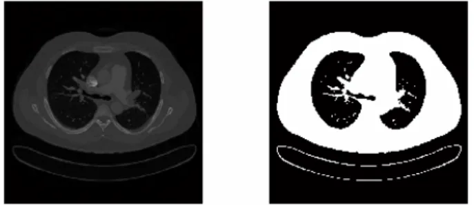 Fig. 4 Identifying lungs as logically 