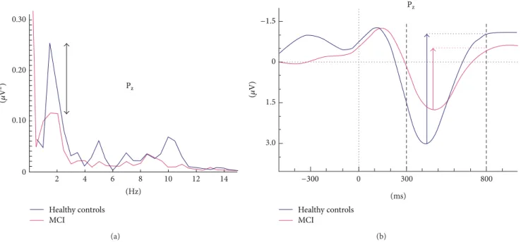 Figure 1: Example of analysis in event-related power spectra and delta response measurements