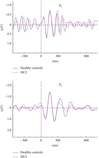 Figure 5: Grand averages of alpha (8–13 Hz) and theta (4–7 Hz) oscillatory responses of healthy control subjects (
