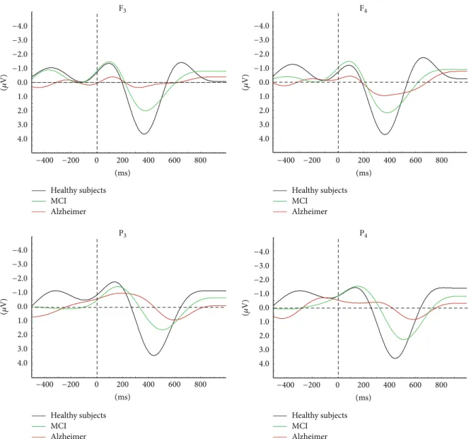 Figure 6: MCI and AD continuity is prominent in auditory event-related delta oscillatory activity