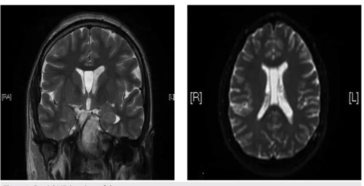 Figure 1: Cranial MR imagings of the case