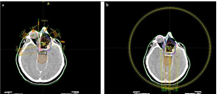 Fig. 1.  (a) An example of the treatment plan for the IMRT technique. (b) An example of the treatment plan for VMAT 