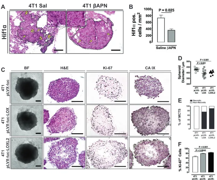 Fig. 4 Reduced supply is a direct effect of a Hif1 α staining in non- non-vascularized spontaneous lung metastases (outlined) arising in mice implanted with 4T1 tumors