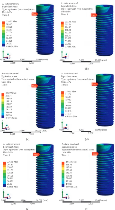 Figure 3: FEA results of implants. Implant materials are AISI 316L stainless steel (a), nanoporous anodic alumina (b), L-605 CoCr alloy (c), cp Ti with the nanotubular TiO 2 surface (d), YSZ (e), and ZTA (f).