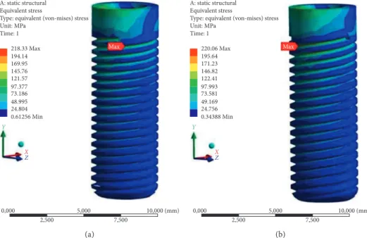 Figure 6: FEA results of implants with 2 threads (a) and 3 threads (b). The implant material is cp Ti with the nanotubular TiO 2 surface.