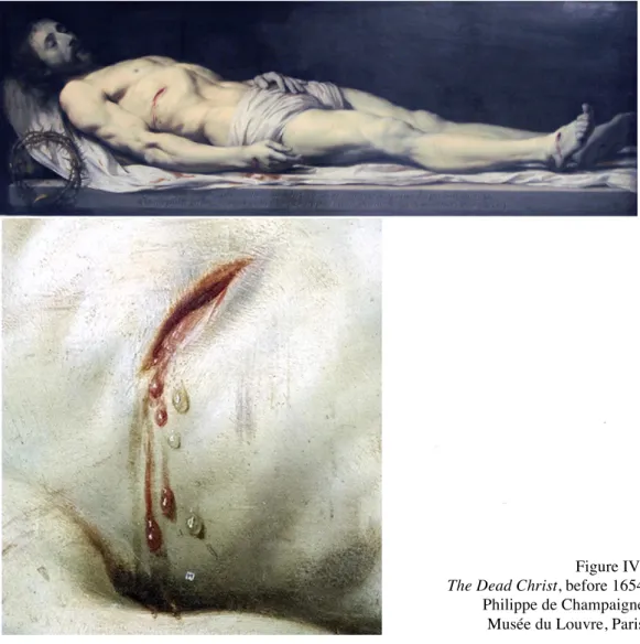 Figure IV:  