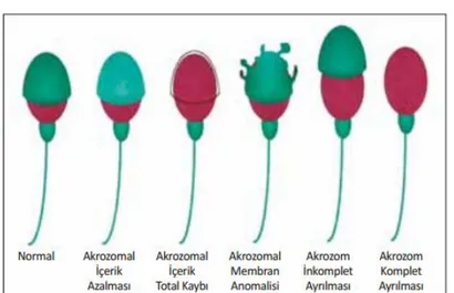 Şekil 8. Sperm baş anomalileri (1) 