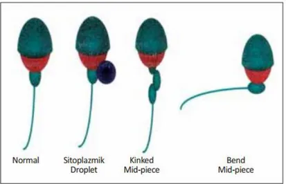 Şekil 9. Sperm boyun anomalileri (1) 