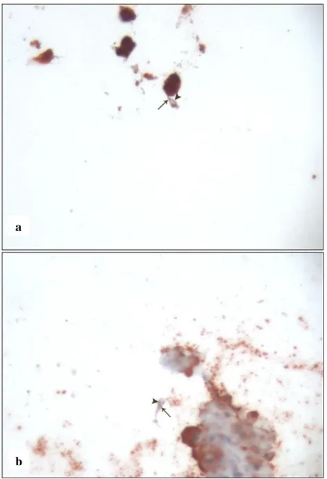 Şekil  4a-b:  Oligospermik  olgulardan  elde  edilen  kesitlerde  spermatozoanın  boyun 