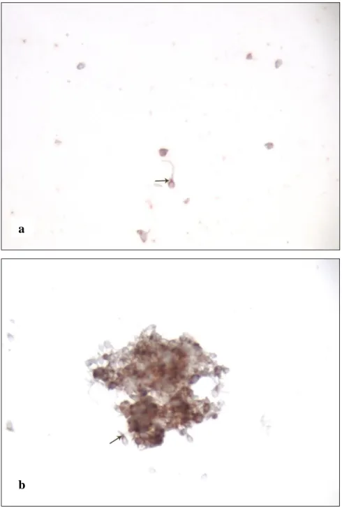 Şekil  6a-b:  Astenospermik  olgulardan  elde  edilen  kesitlerde  spermatozoonun  boyun 