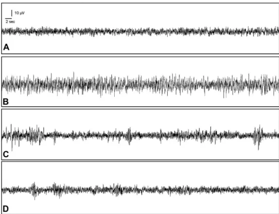 Figure 1. Electroencephalographic (EEG) recording. (A) Control group; (B) pentylenetetrazole and saline group; (C) pentyle- pentyle-netetrazole and rebaudioside A (100 mg/kg) group; and (D) pentylepentyle-netetrazole and rebaudioside A (200 mg/kg) group.