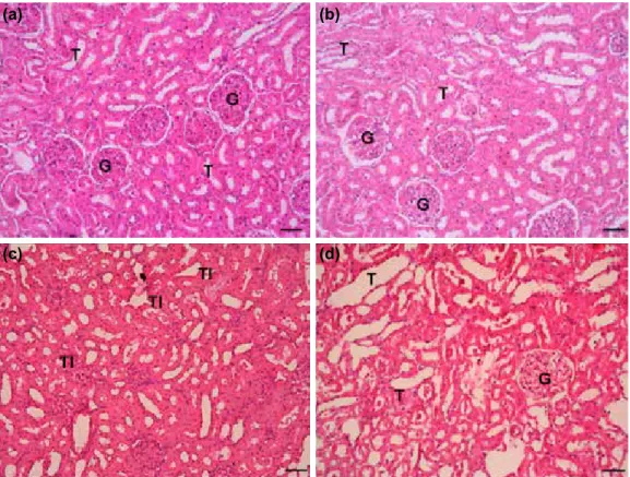 Figure 1. Kidney histolopathology. (a) Kidney from normal group, H&amp;E x10 magnification, renal tubuls (T),  (b) sham group showed minimal histopathological alteration, (c) CLP+saline group showed severe 