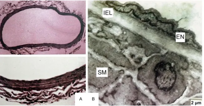 Figure 4. A. Control group, light microscopic examination. B. Control group, TEM examination the of femoral artery