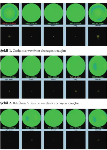Şekil 1. Gözlüksüz wavefront aberasyon sonuçları 