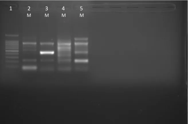 Şekil  11:  Mutasyonlar için heterozigot genotipteki kontrol DNA’ları kullanılarak mutant  allele  özgü  primerleri  içeren  karışımlar  ile  gerçekleştirilen  multipleks  PZR  ürünlerinin  %2.5’luk  agaroz  jel  elektroforez  analiz  görüntüleri