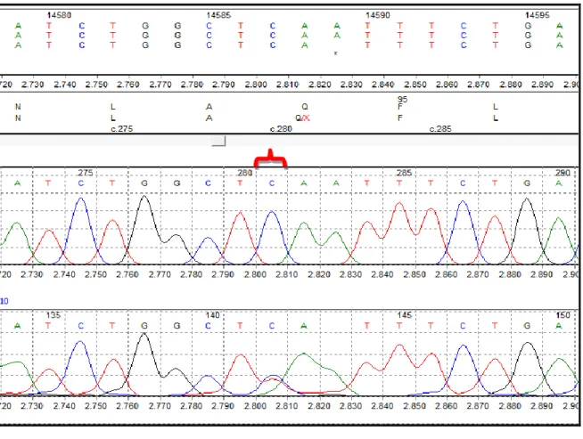 Şekil 13.7. a) 15. hastadaki değişimlerin sekans analizi görüntüsü.   c.14587C&gt;T Heterozigot Değişikliği, p.Q94X