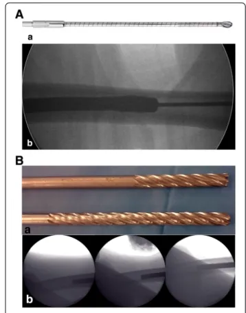 Fig. 2 Computed tomography image of the femur in the sagittal section; the medullary canal has a greater antecurvature than that of the whole femur