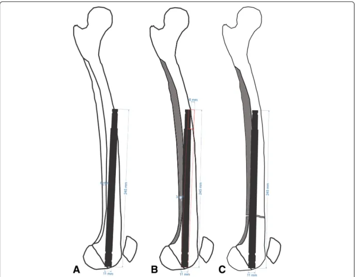 Fig. 7 a A 6-mm protrusion of the nail tip on the anterior cortex in an unreamed application with a straight nail
