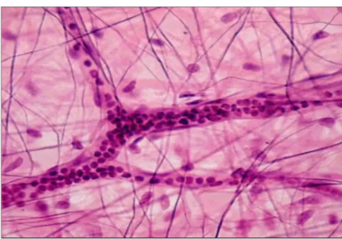 Şekil 11: Fibroblastlar (63) 