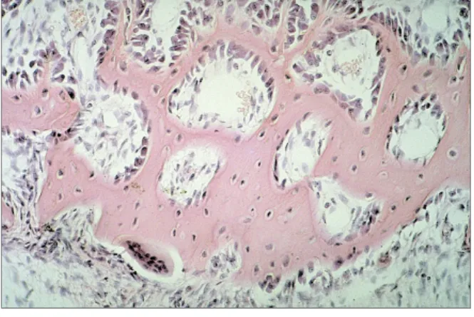 Şekil 14: Osteoblastlar (63) 