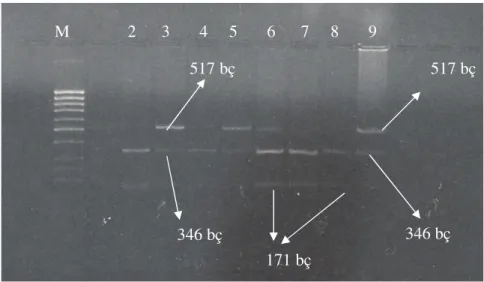 Şekil 7. PZR ürünlerinin kesimi ile elde edilen Glu 298-Asp genotipleri 