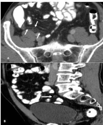 Fig 1 .  Contrast Enhanced Computed Tomography 