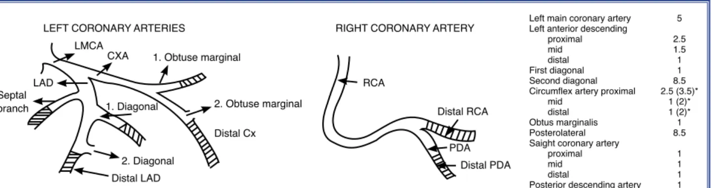 Figure 1. Position of the lesion in coronary arterial tree. LMCA: Left main coronary artery; LAD: Left anterior descending artery;  Cx: Circumflex artery; RCA: Right coronary artery; PDA: Posterior descending artery.