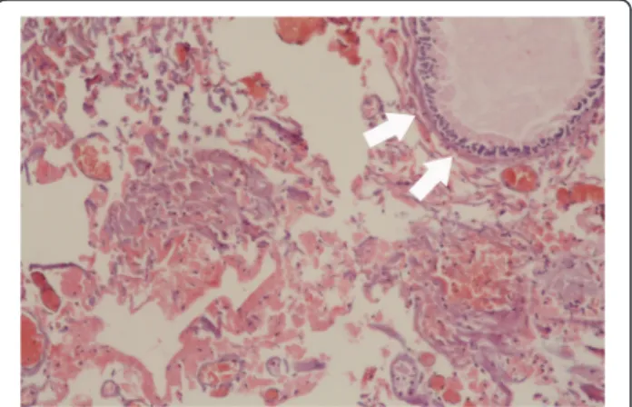 Figure 2 Coronal paranasal sinus computed tomography images 2 months after the operation showing no signs of recurrence or inflammation.