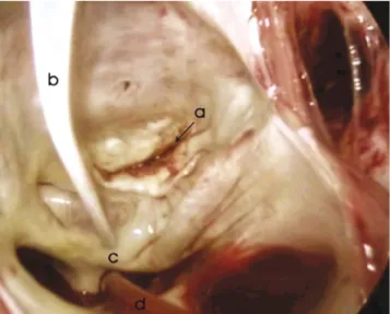 Fig. 1. The pen shaped probe allows sufficient endothoracic movement from a port access approach.