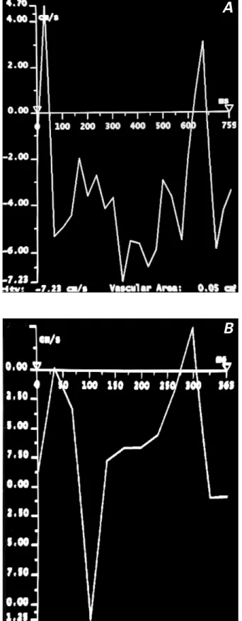 Fig. 2  Magnetic resonance flow mapping with use of the