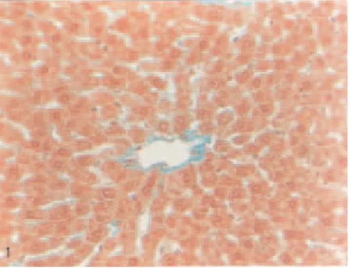 Fig. 1. Liver of a control rat (intact). Masson’s tri-dye. Magnification:  ×320.