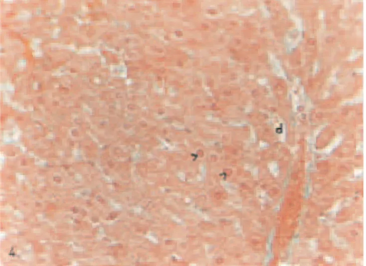 Fig. 4. Liver of a STZ-diabetic animal given vanadium. Less pycnotic nuclei (&gt;) and sinusoidal dilations (d)