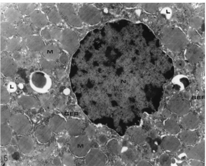 Fig. 6. An electron micrograph of the hepatocytes of a diabetic rat. Swelling in granular endoplasmic reticulum (GER), mitochondria surrounding with dilated granular endoplasmic reticulum (M), the dilation in perinuclear space ( →),  pyc-notic nucleus (N),