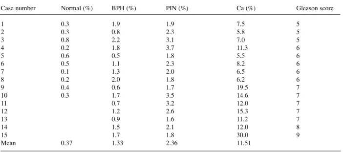Table 1: Individual case means Ki-67 indices (%).