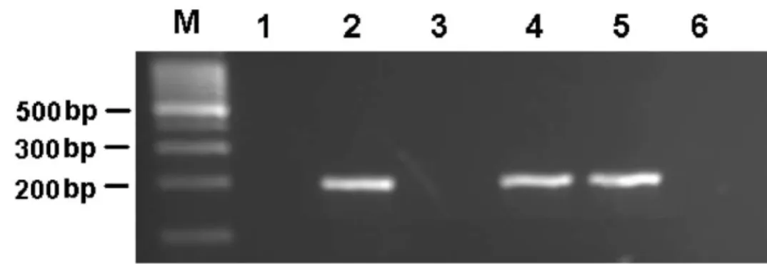 Fig. 1. The results of TTV-DNA positive and negative cases; and the positive and negative controls in agarose gel electrophoresis