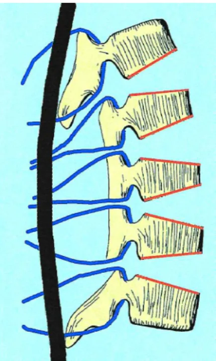 Figure 2. Illustration of the surgical technique used in both of our cases