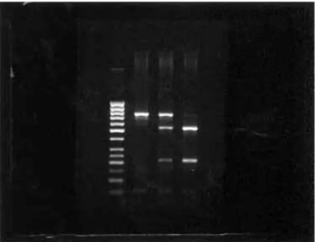 Fig. 1. RFLP results of ApaI enzyme. Lane 1, Gene RulerTM 50 bp DNA Ladder. Lane 2, AA genotype (740 bp, homozygous)