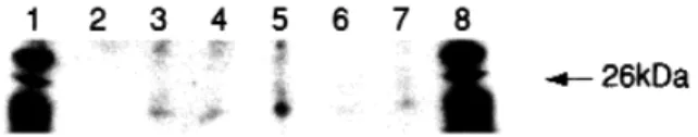 Fig 2. Western blots of Cx26 from various human myometrial