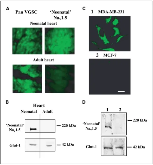 Fig. 4. Characterization of neonatal Na v 1.5 expression. A, immunohistochemical comparison of neonatal Na v 1.5 expression (as detected with the neonatal Na v 1.5-specific voltage-gated Na + channel antibody, NESOpAb) to ‘‘total’’ VGSC expression (as dete