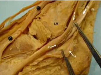Figure 4. Lateral aspect of the left ankle joint.  1: Proximal end 