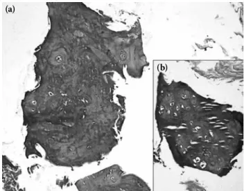Figure 3. (a) Disc tissue of the ochronotic patient after sur- sur-gery. (b) Disc tissue of another patient without ochronosis.