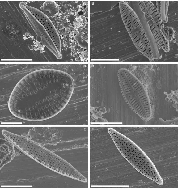 Figure 3 Scanning electron micrographs of some abundant taxa in epibiont diatom assemblages asso- asso-ciated with Caretta caretta