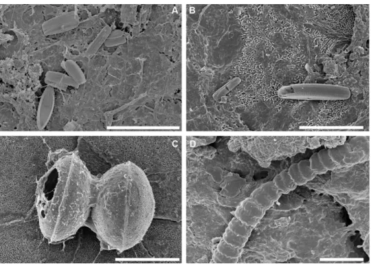 Figure 5 SEM observations of intact biofilm fragments from Caretta caretta. (A) Biofilm rich in epizoic diatoms mainly Tripterion sp