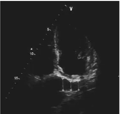 Figure 1. Echocardiographic measurements of coronary sinus are  shown