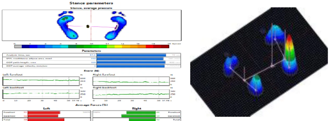 Şekil 3. 2 Zebris FDM-2 platformu 