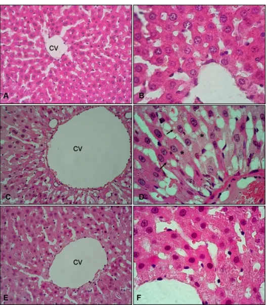 Figure 2: Liver histolopathology H&amp; E (x 40 and x 100), A-B: Normal liver (control group),  